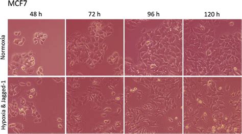 Morphology of MCF7 cells after treatment with Jagged-1 and hypoxia over ...