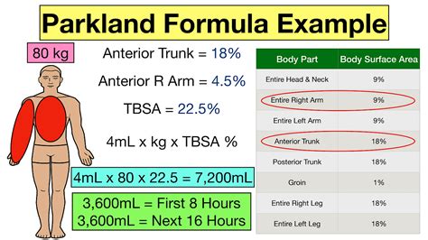 Parkland Formula for Burns: Pediatric and Adult Examples, Calculator, Practice Questions — EZ ...