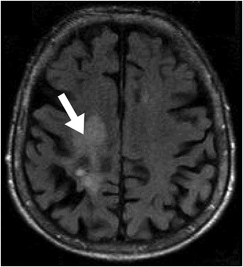 31 | Radiology Key