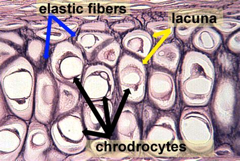 Elastic Cartilage (DESCRIPTION: most flexible of the cartilages) (found ...