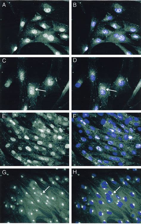 Immunocytochemical localization of SRF (fluorescein isothiocyanate ...