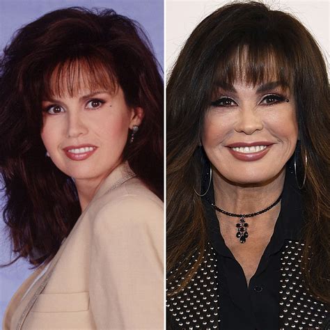 Has Marie Osmond Gotten Plastic Surgery? Our Experts Weigh In!