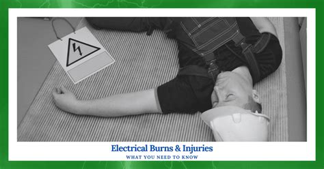 Electrical Burns and Injuries: What You Need To Know