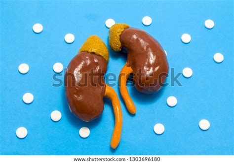 6 Renal Amyloidosis Images, Stock Photos & Vectors | Shutterstock