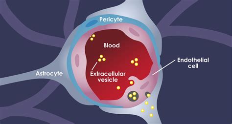 How cancer vesicles breach the blood-brain barrier | National Institutes of Health (NIH)