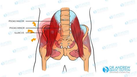 Hip Flexor Strain: A Guide to Understanding and Healing | A/Professor ...