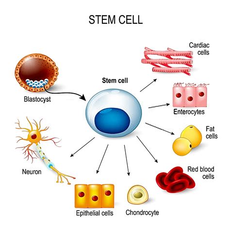 Affordable Cost Stem Cell Therapy in Mumbai, India - MedAcess