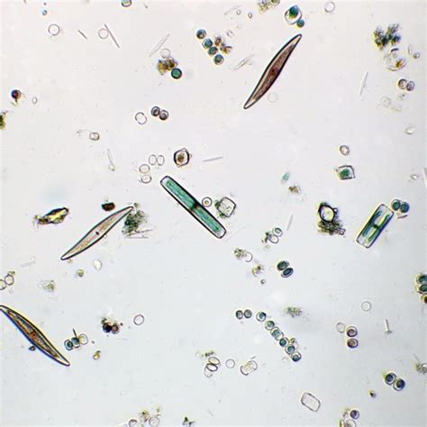 Diatom Cell Slide