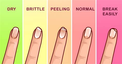 What your nails say about your health (8 pictures)