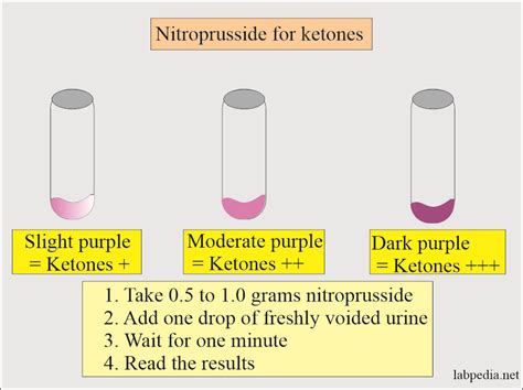 Nitroprusside Test- Definition, Principle, Procedure,, 47% OFF