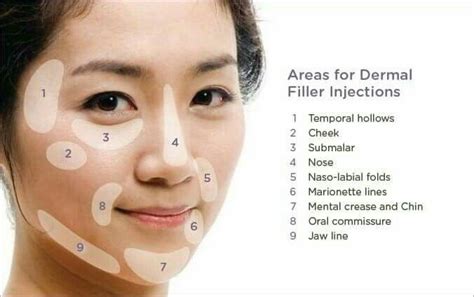 Areas for Dermal Filler Injections 😷 | Injectables fillers, Dermal ...