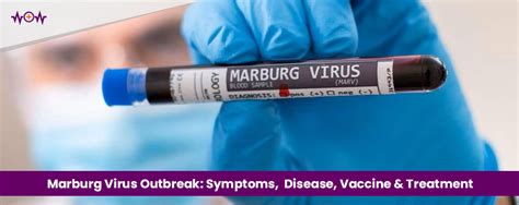 Marburg Virus Outbreak: Symptoms, Disease, Vaccine & Treatment