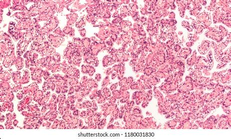 177 Choroid Plexuses Images, Stock Photos & Vectors | Shutterstock