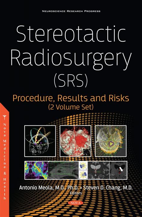 Stereotactic Radiosurgery (SRS): Procedure, Results and Risks (2 Volume Set) – Nova Science ...