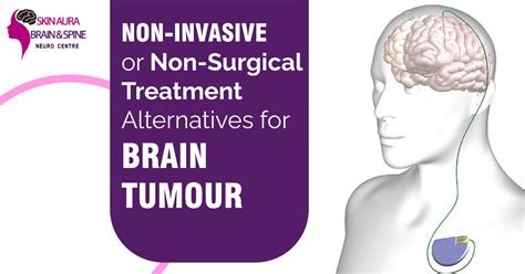 Brain Tumor Treatment Without Surgery - Dr. Vikas Kathuria