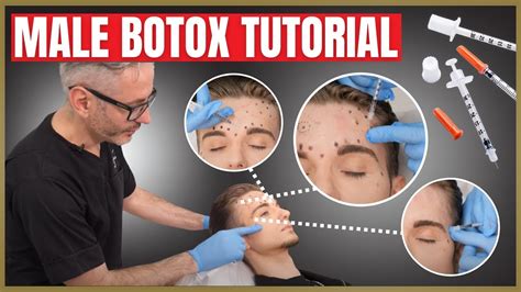 Botox Injection Sites