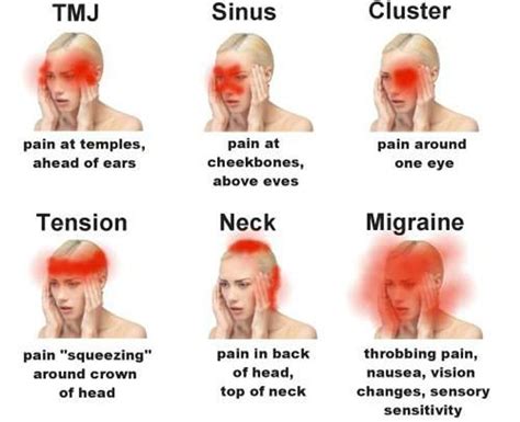 What is your headache telling you? 6 most important warning signs. | Tipos de dor de cabeça, Dor ...