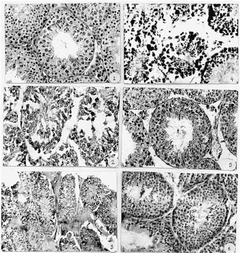 Photomicrographs of testis of Swiss albino mice showing various ...