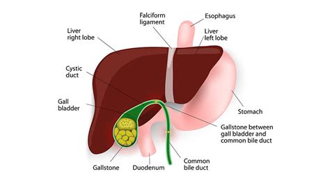 Cholecystectomy | Surgery - Dr Mikhail Mastakov