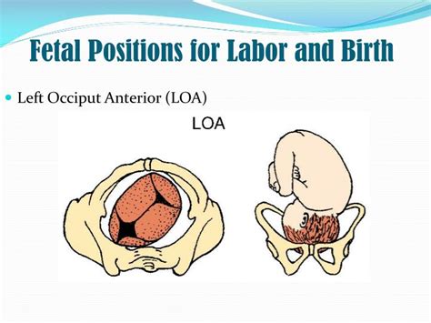 PPT - Physiology of delivery. Analgesia in labor. PowerPoint Presentation - ID:6432824