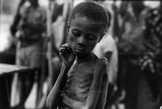 An Ibo child, during the famine due to the civil war, Biafra, Nigeria ...