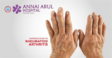 INTRODUCTION TO RHEUMATOID ARTHRITIS – Multispeciality Hospitals in Chennai