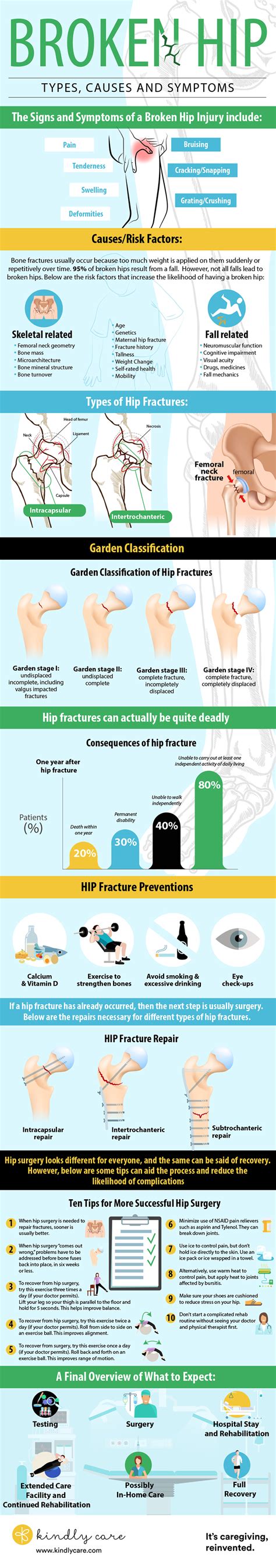 Broken Hip: Types, Causes and Symptoms | CareLinx