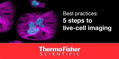 Best practices: 5 steps to live-cell imaging