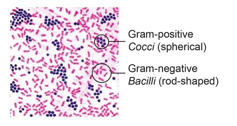 Bacteria Gram Stain Morphology