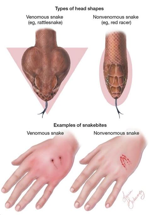 Venomous vs nonvenomous snakes | Survival, Survival life hacks, Useful life hacks