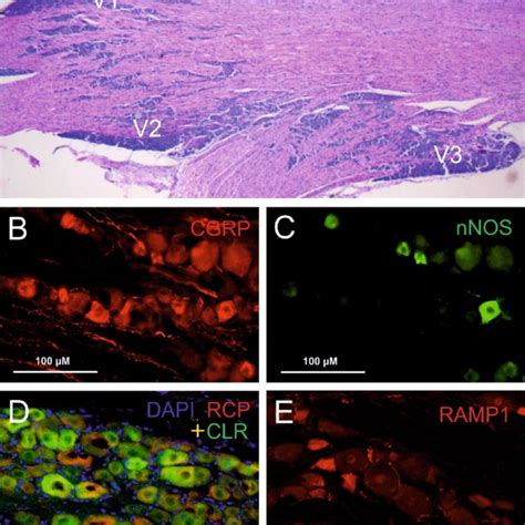 (PDF) Cross-talk signaling in the trigeminal ganglion: role of neuropeptides and other mediators