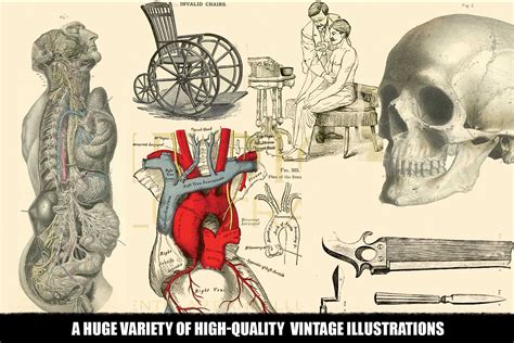 100 Vintage Medical Illustrations By Dene Studios | TheHungryJPEG