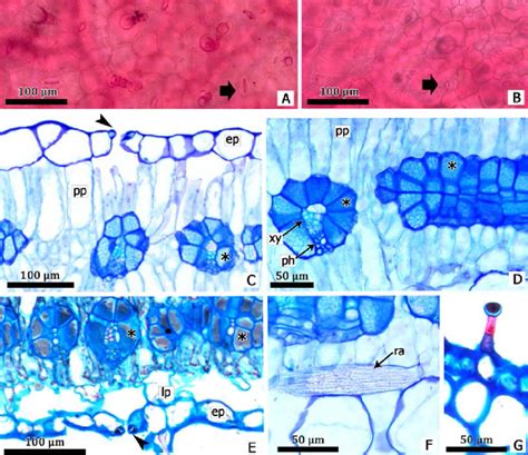 Anatomy of leaf blade in Allionia incarnata. 2a-b. Leaf surface showing... | Download Scientific ...