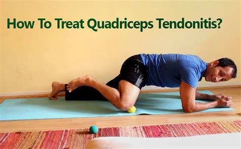 How To Treat Quadriceps Tendonitis? - How to treat quadriceps tendon injury or quadriceps ...