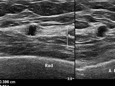 Breast Lump Common Questions & Answers | Woman's Clinic