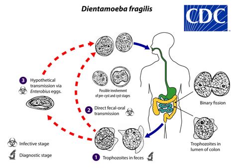 Dientamoeba fragilis infection, life cycle, symptoms, diagnosis & treatment