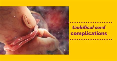 Umbilical cord complications - Health Care Fix