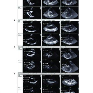 | Echocardiographic imaging of vorinostat effects in calves with... | Download Scientific Diagram