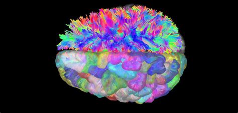 Split brain does not lead to split consciousness