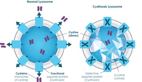 What is Cystinosis? – The Australian Cystinosis Foundation