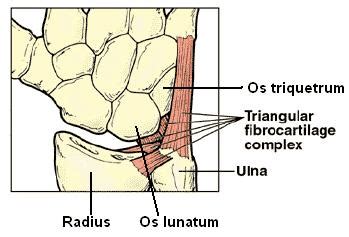 What is triangular fibrocartilage complex (TFCC) Injuries