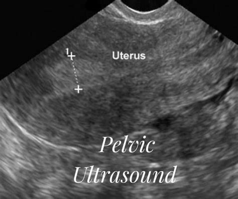 Ultrasound - Check Out Our Ultrasound Services for Kailua Hawaii | Ultracare Diagnostic Imaging ...