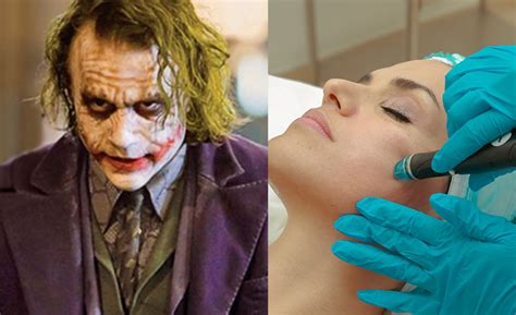 Joker Makeup Scars | Saubhaya Makeup