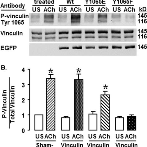 Vinculin constructs used in these studies. A, domain structure of... | Download Scientific Diagram