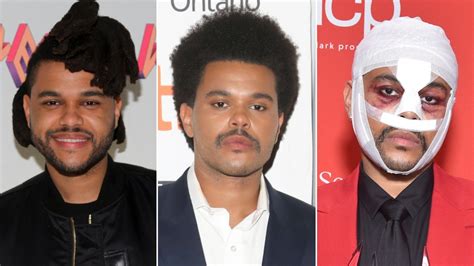 The Weeknd Transformation: Music Videos, Plastic Surgery and More