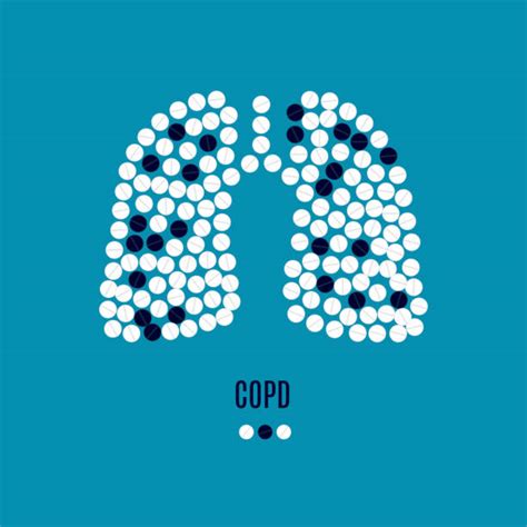 Copd Illustrations, Royalty-Free Vector Graphics & Clip Art - iStock