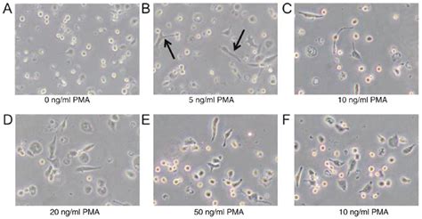 Morphological changes and adherence rates of THP-1 cells induced with ...