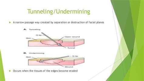 tunneling wound vs undermining - Caption Simple