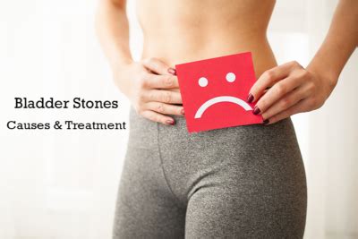 What Are Bladder Stones? Causes and treatment | Dr. Irfan Shaikh | Urolife Clinic, Pune