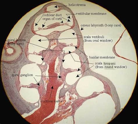 MEDICAL IMAGES: Spiral ganglion